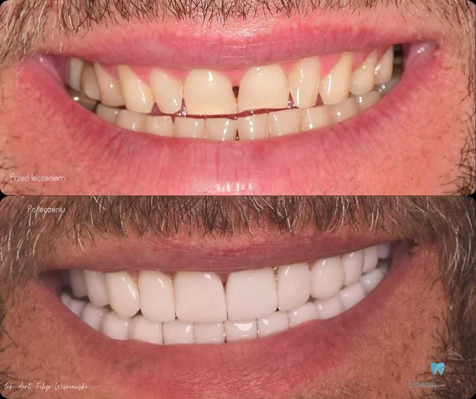 Hollywood Smile Lubin